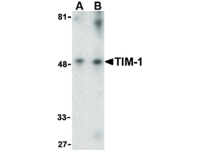 TIM-1 Antibody in Western Blot (WB)