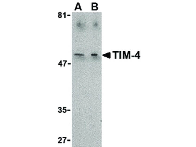 TIM-4 Antibody in Western Blot (WB)