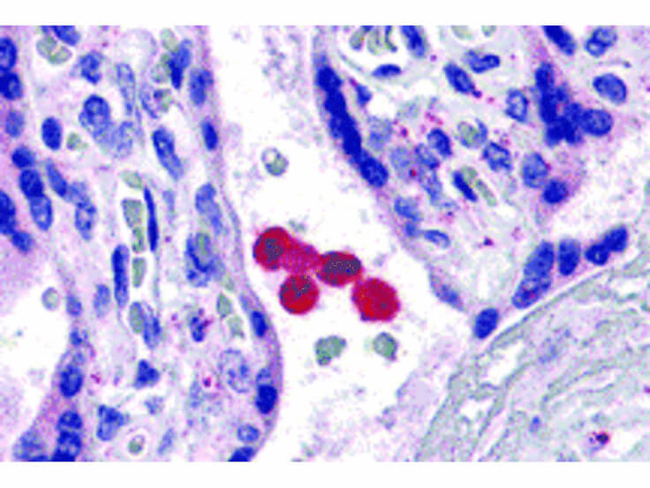 TLR4 Antibody in Immunohistochemistry (Paraffin) (IHC (P))