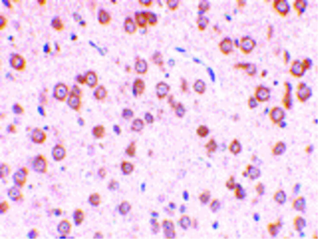 TLR5 Antibody in Immunohistochemistry (Paraffin) (IHC (P))