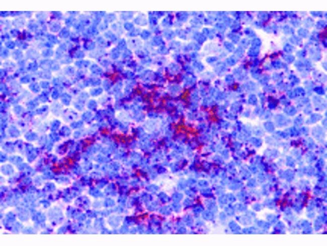TLR8 Antibody in Immunohistochemistry (Paraffin) (IHC (P))