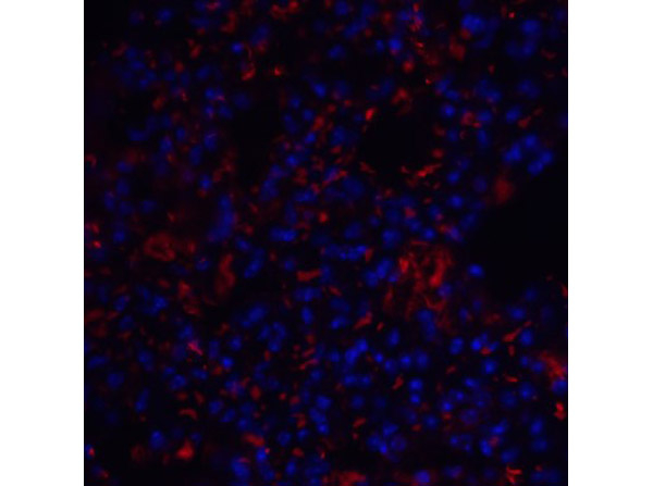 TM4SF1 Antibody in Immunocytochemistry (ICC/IF)