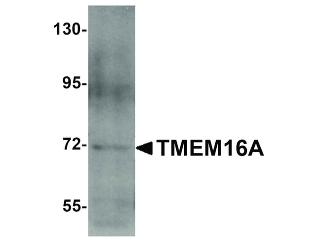 TMEM16A Antibody in Western Blot (WB)