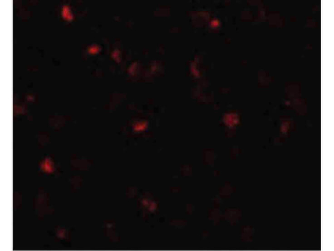 TMEM16B Antibody in Immunocytochemistry (ICC/IF)