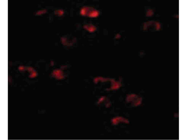 TMEM18 Antibody in Immunocytochemistry (ICC/IF)