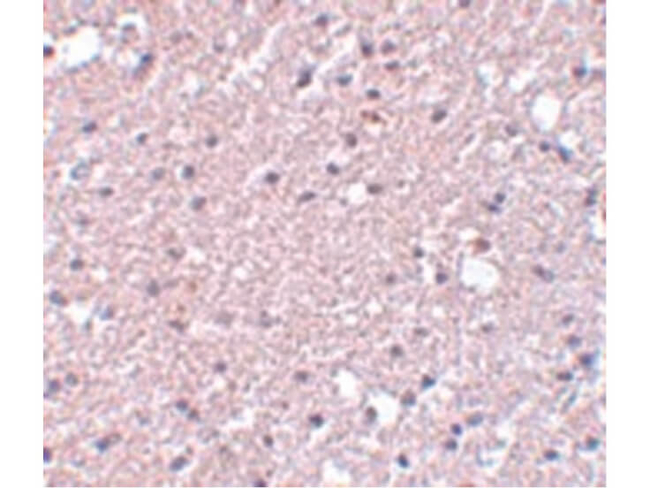 TMEM184A Antibody in Immunohistochemistry (Paraffin) (IHC (P))