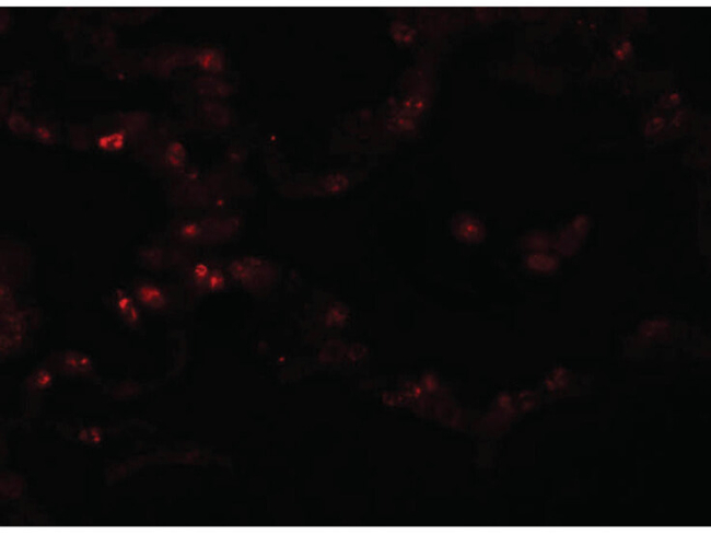 TMEM184B Antibody in Immunocytochemistry (ICC/IF)
