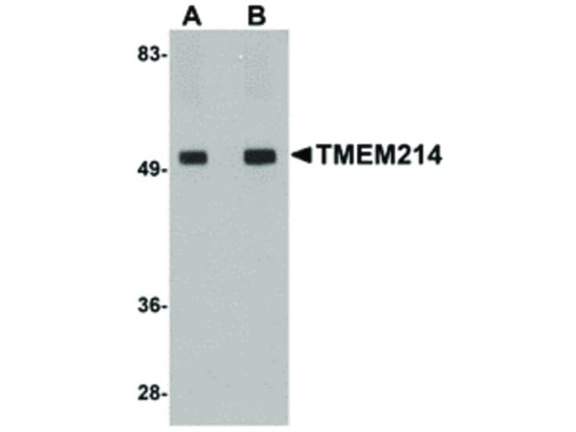 TMEM214 Antibody in Western Blot (WB)