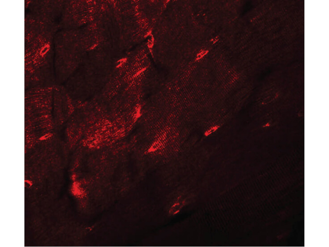 TMEM38A Antibody in Immunocytochemistry (ICC/IF)