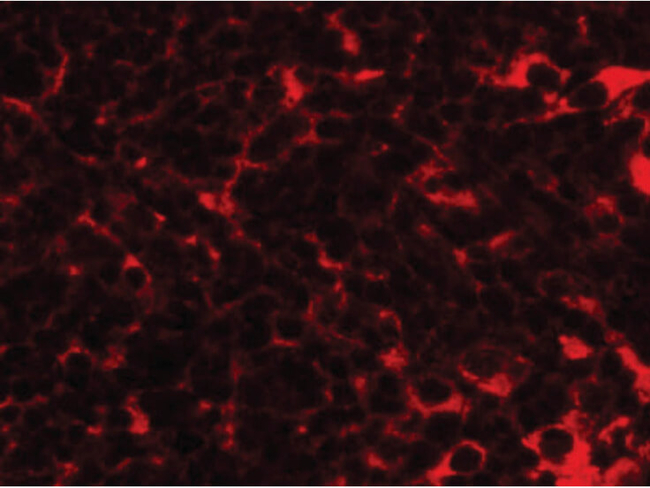 TMEM38B Antibody in Immunocytochemistry (ICC/IF)