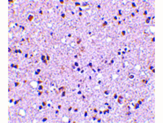 TMP21 Antibody in Immunohistochemistry (Paraffin) (IHC (P))