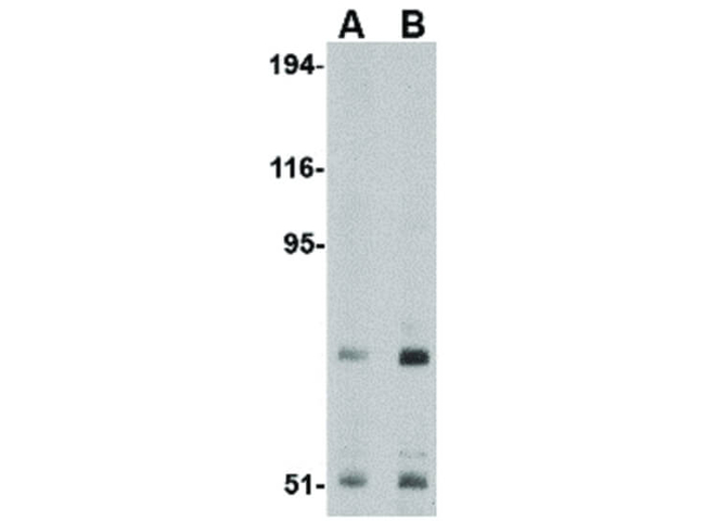 TNPO3 Antibody in Western Blot (WB)