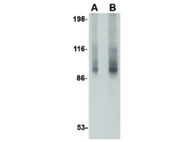 TNPO3 Antibody in Western Blot (WB)