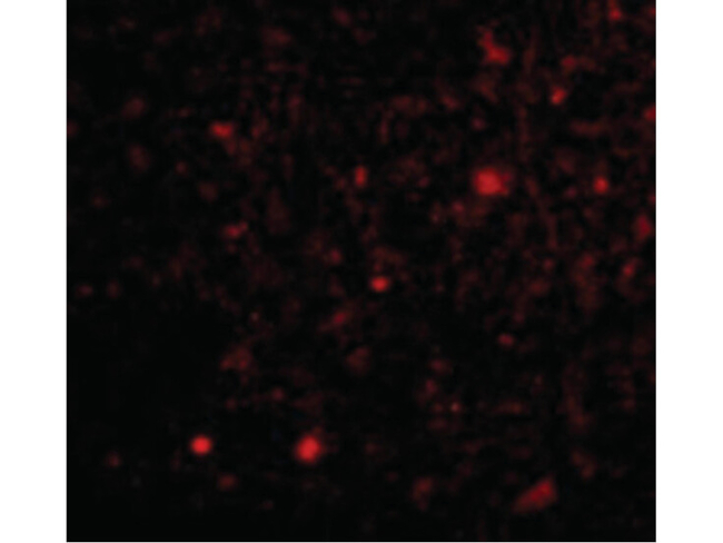 TOCA-1 Antibody in Immunocytochemistry (ICC/IF)