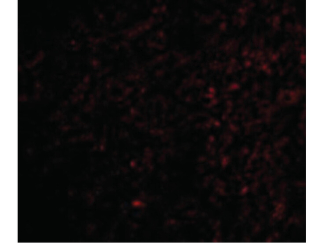 TOCA-1 Antibody in Immunocytochemistry (ICC/IF)