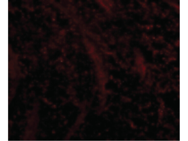 TOM70 Antibody in Immunocytochemistry (ICC/IF)