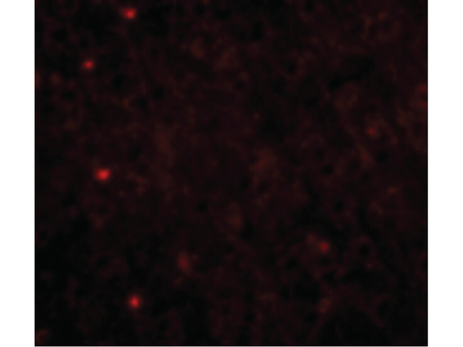 TOM70 Antibody in Immunocytochemistry (ICC/IF)