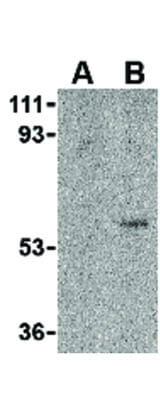 TOSO Antibody in Western Blot (WB)