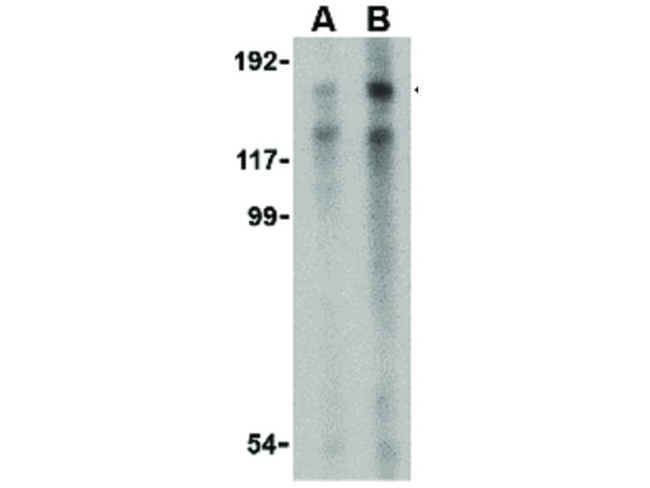 TRBP1 Antibody in Western Blot (WB)