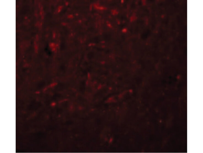 TRESK Antibody in Immunocytochemistry (ICC/IF)