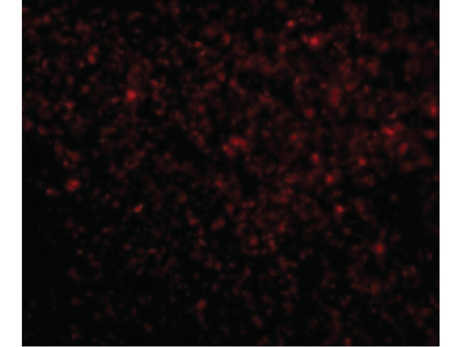TREX1 Antibody in Immunocytochemistry (ICC/IF)