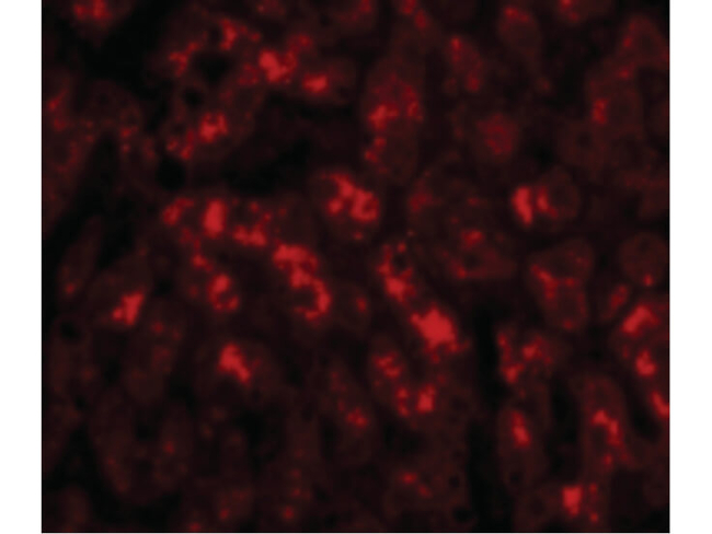 TREX2 Antibody in Immunocytochemistry (ICC/IF)