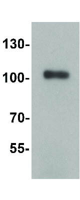 TRIM28 Antibody in Western Blot (WB)