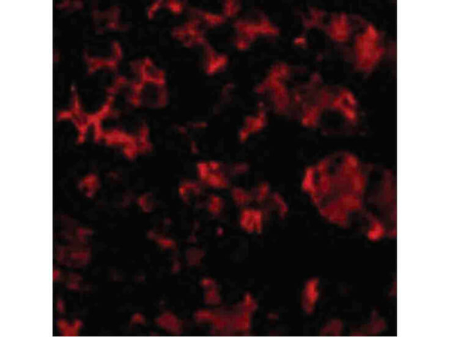 TRIM5 alpha Antibody in Immunocytochemistry (ICC/IF)