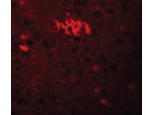 TRIM71 Antibody in Immunocytochemistry (ICC/IF)