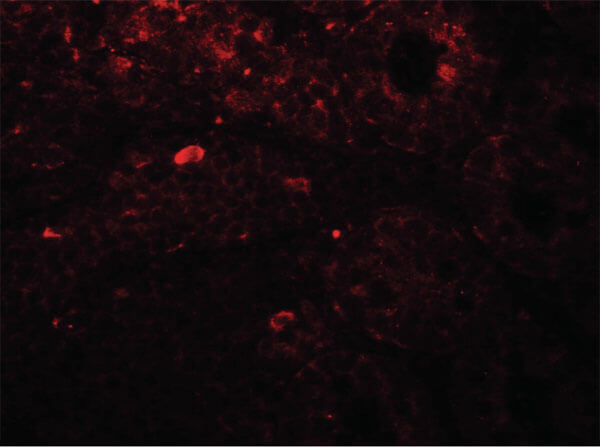TRIP12 Antibody in Immunocytochemistry (ICC/IF)