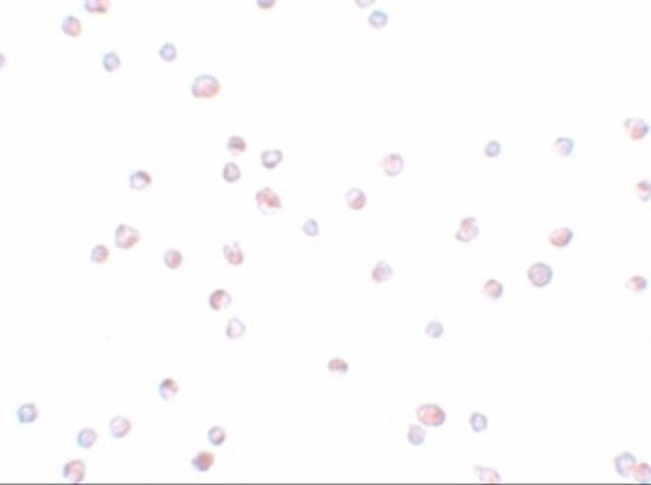 TRIP6 Antibody in Immunocytochemistry (ICC/IF)