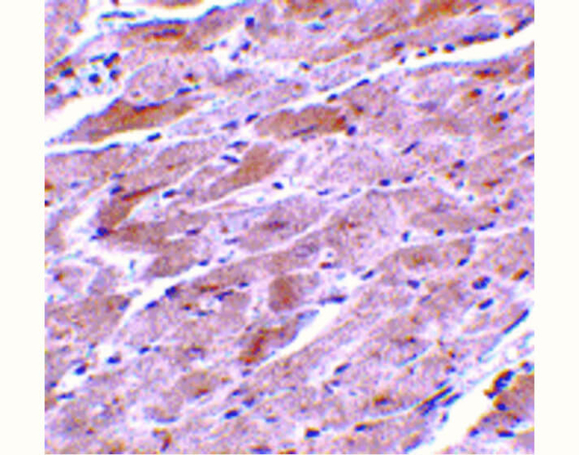 TRPC3 Antibody in Immunohistochemistry (Paraffin) (IHC (P))