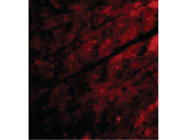 TRPC3 Antibody in Immunocytochemistry (ICC/IF)