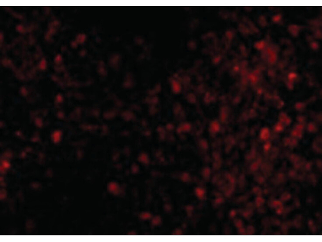 TRPC6 Antibody in Immunocytochemistry (ICC/IF)