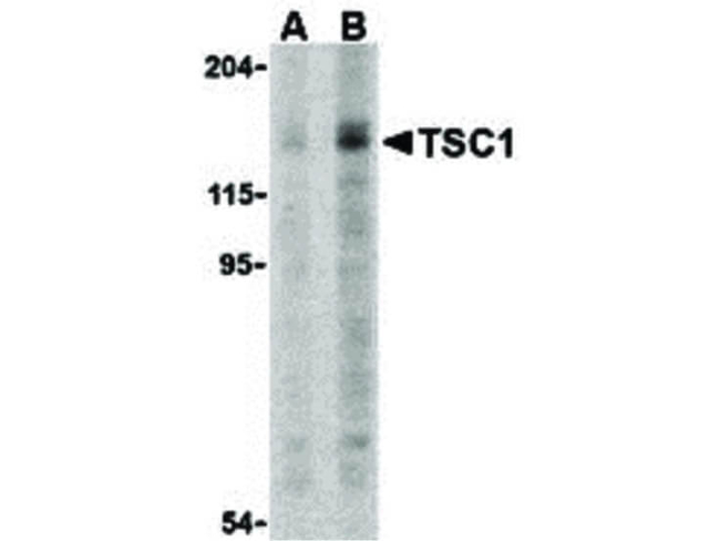 TSC1 Antibody in Western Blot (WB)