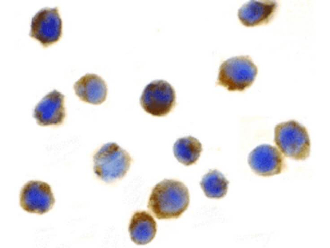 TSC1 Antibody in Immunocytochemistry (ICC/IF)