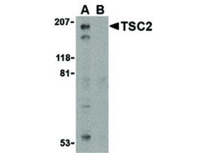 TSC2 Antibody in Western Blot (WB)