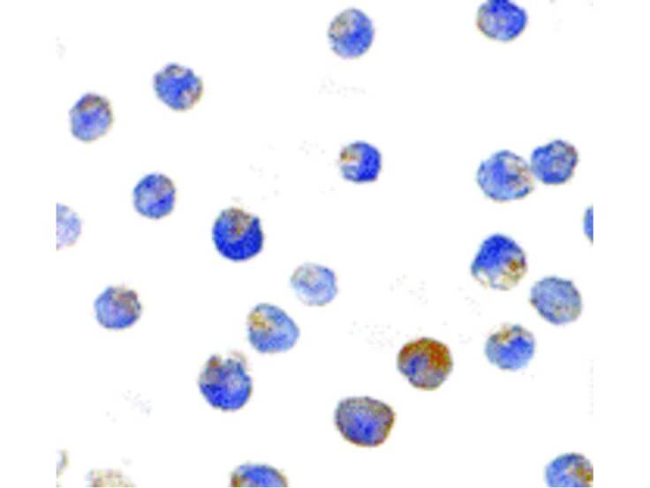 TSC2 Antibody in Immunocytochemistry (ICC/IF)