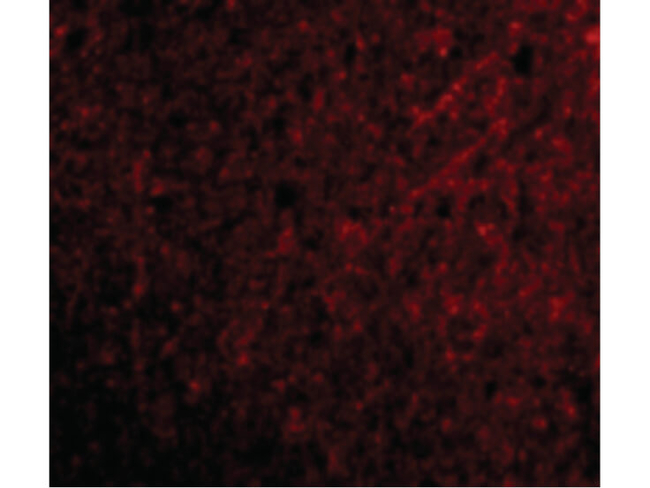 TSLP Antibody in Immunocytochemistry (ICC/IF)