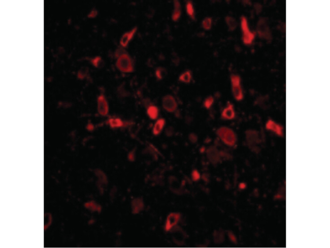 Tslp Antibody in Immunocytochemistry (ICC/IF)