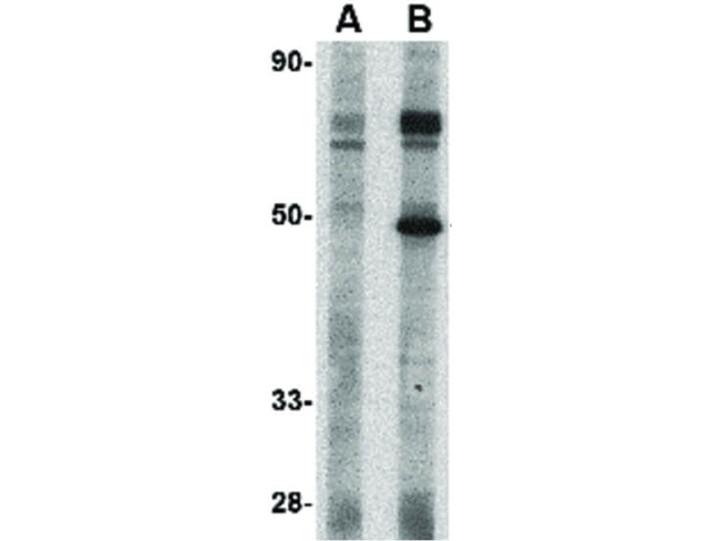 Tslp Receptor Antibody in Western Blot (WB)