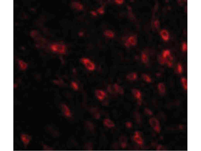 TTBK1 Antibody in Immunocytochemistry (ICC/IF)