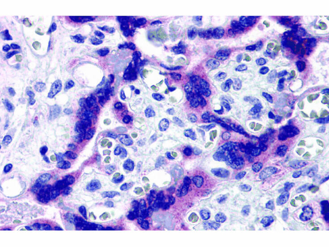 TTBK2 Antibody in Immunohistochemistry (Paraffin) (IHC (P))