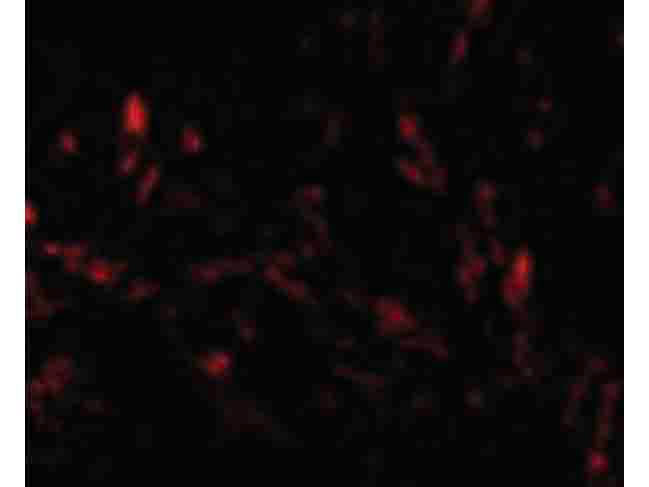 TTC5 Antibody in Immunocytochemistry (ICC/IF)