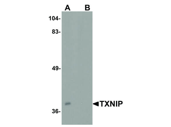 TXNIP Antibody in Western Blot (WB)