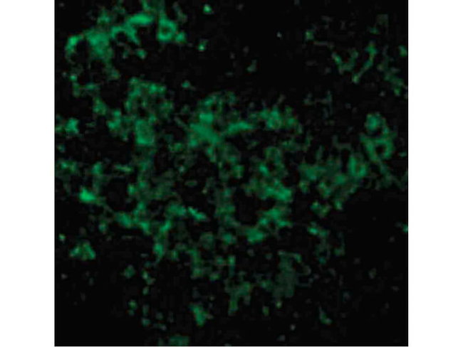 UBC13 Antibody in Immunocytochemistry (ICC/IF)
