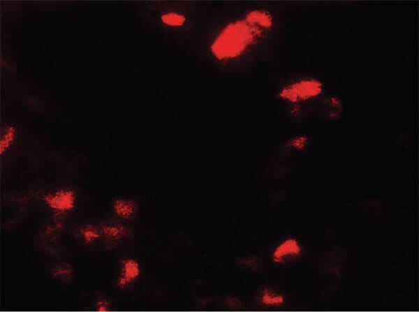 UBIAD1 Antibody in Immunocytochemistry (ICC/IF)