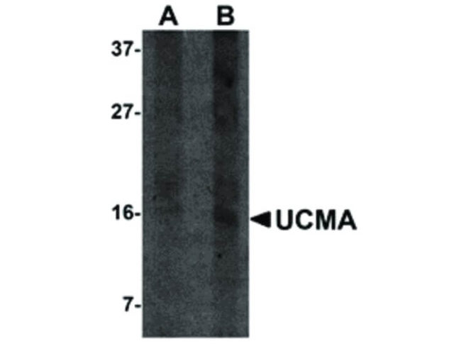 UCMA Antibody in Western Blot (WB)