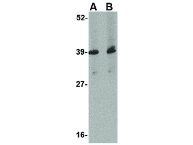 UROP11 Antibody in Western Blot (WB)