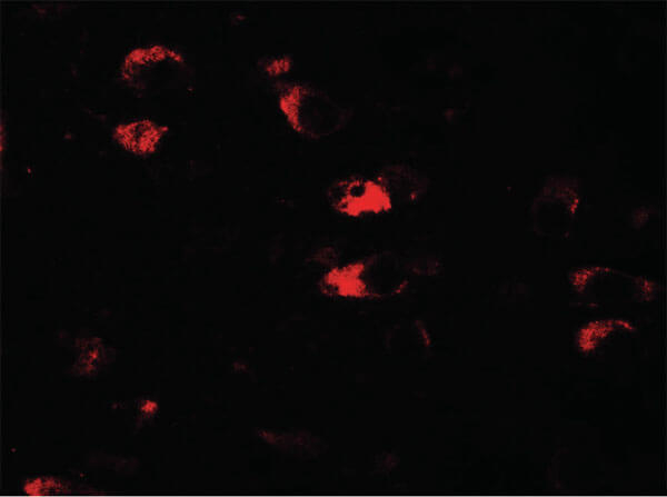 USP25 Antibody in Immunocytochemistry (ICC/IF)